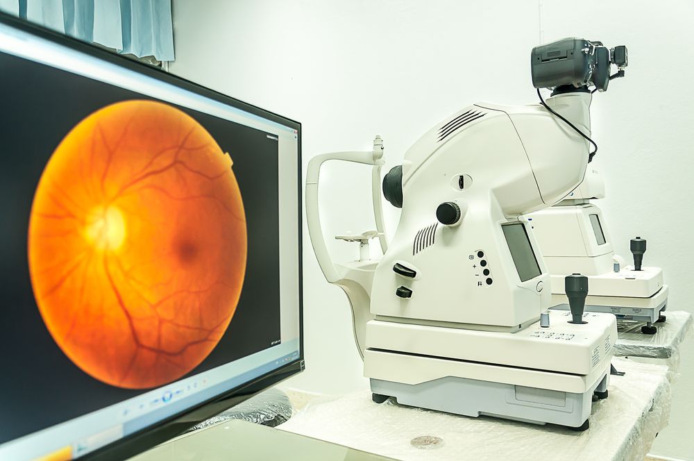 What Is a Fundus Camera?