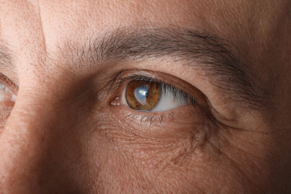 What Are the First Signs that Glaucoma is Developing?