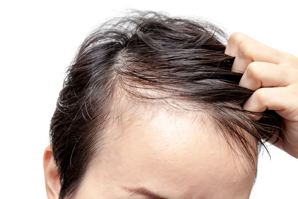 Are You Experiencing Hair Loss or Thinning?