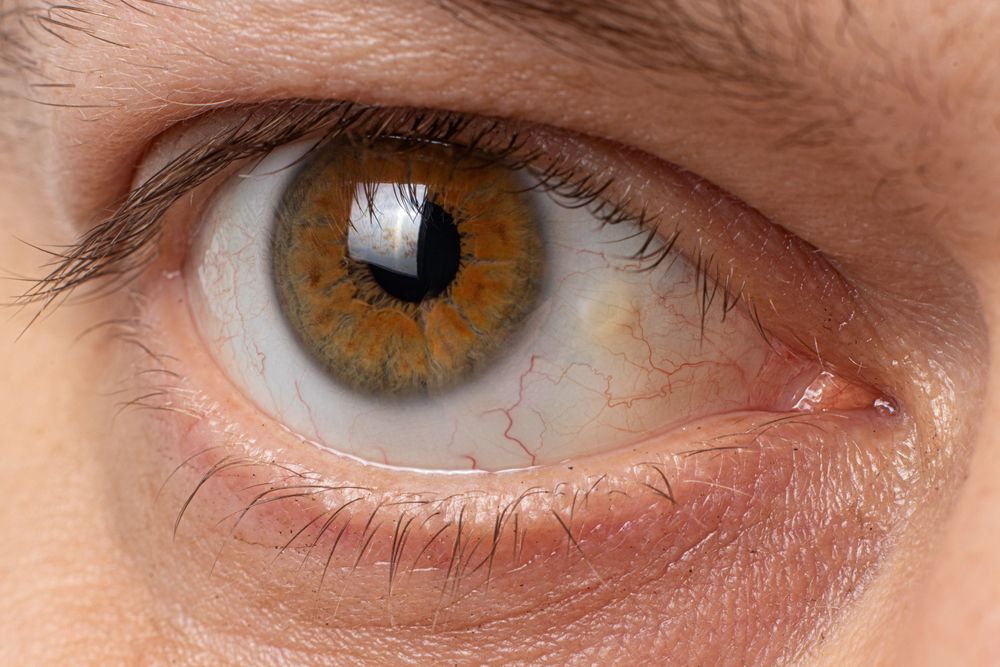 Cornea Health and Aging: Addressing Common Issues in Older Adults