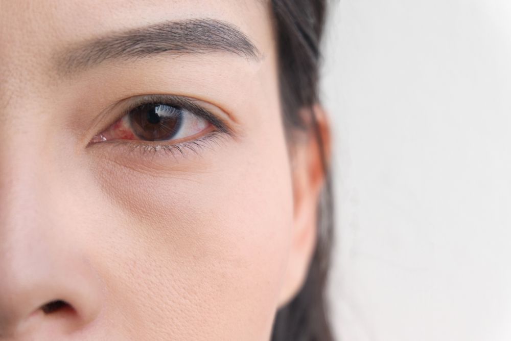 Can Dry Eye Be a Symptom of Something Serious?