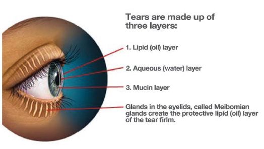 tear layers