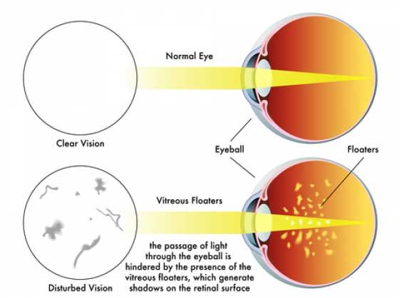 retina at Vision Eye Max, LLC, in Katy, TX