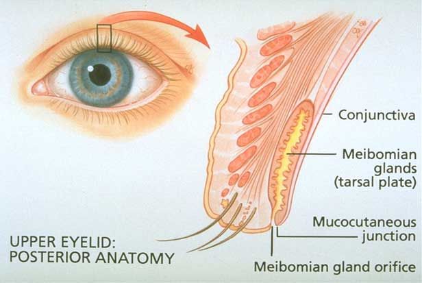 eyelid at Vision Eye Max, LLC, in Katy, TX