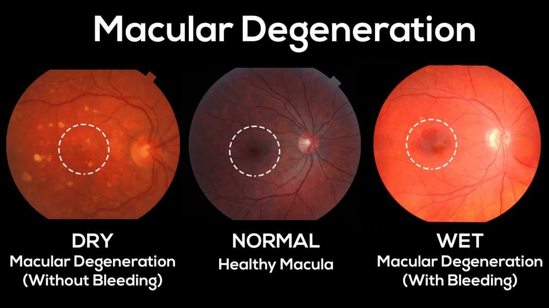 retina at Vision Eye Max, LLC, in Katy, TX