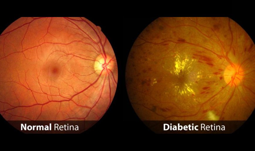 retina at Vision Eye Max, LLC, in Katy, TX