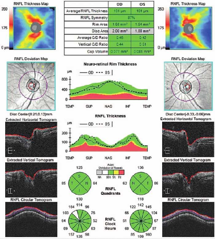 retina at Vision Eye Max, LLC, in Katy, TX