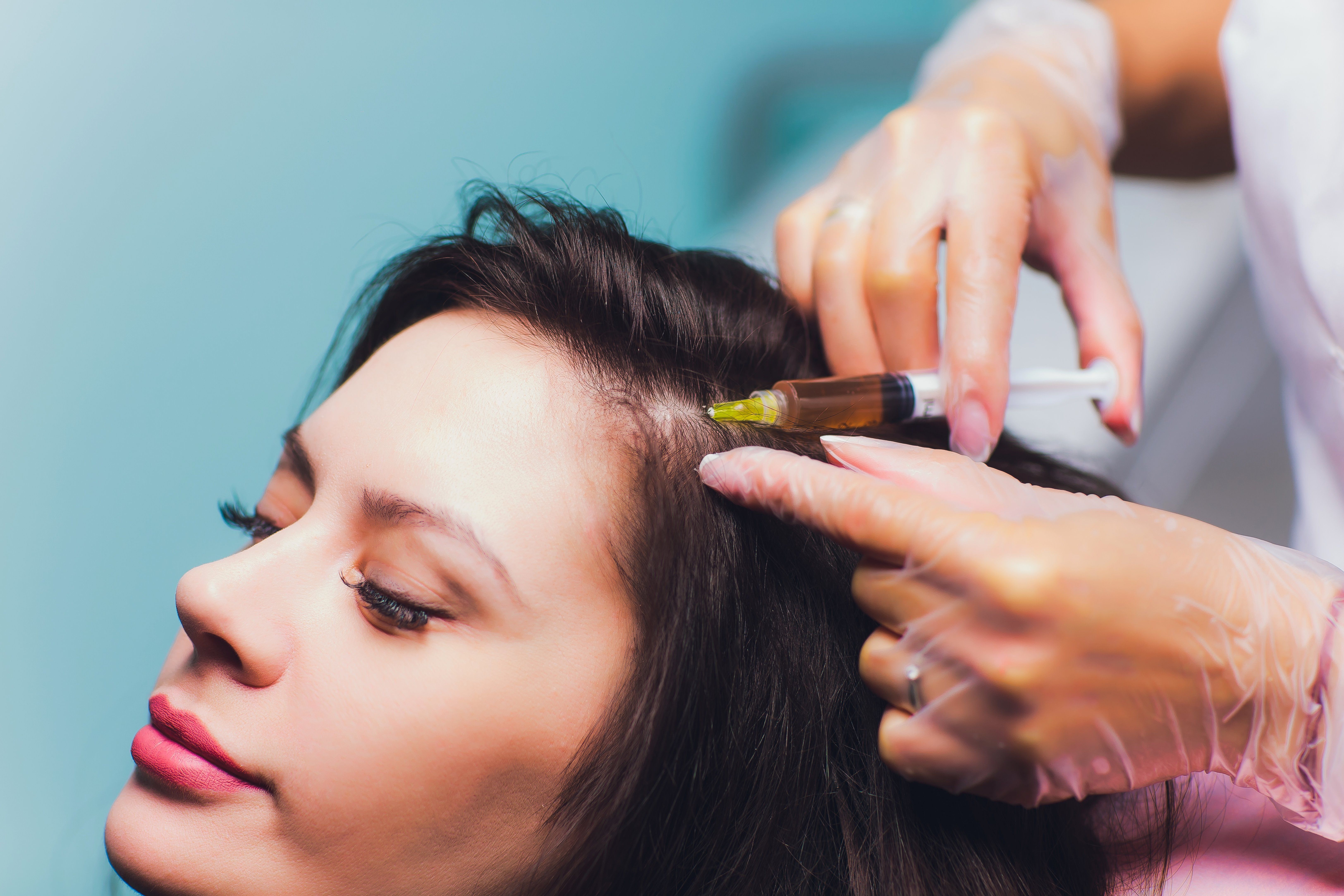 The Benefits of PRP Hair Restoration for Female Hair Loss