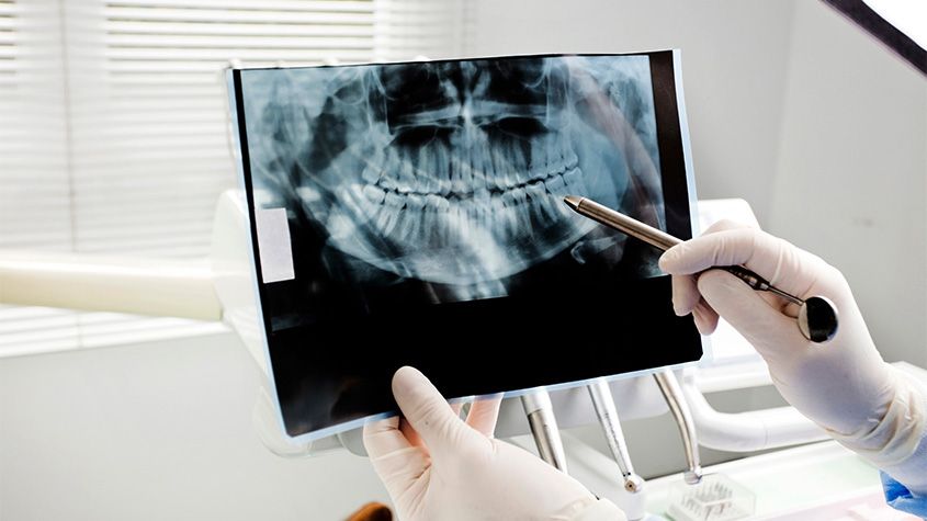 Dental Cleaning and X-Rays