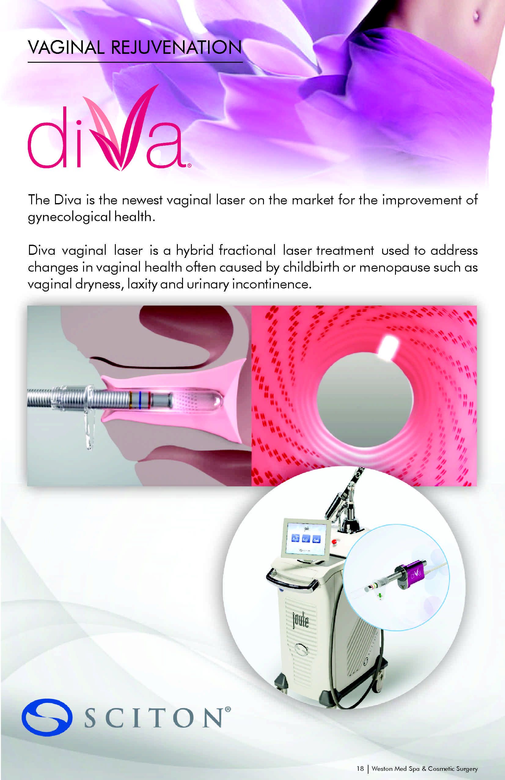 Laser Treatments - Reverse Aging | Plastic Surgeon in Weston Laser Treatments - Reverse Aging | Plastic Surgeon in Weston