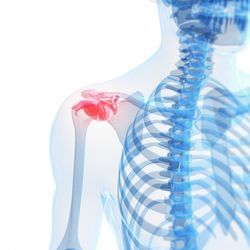 rotator cuff repair