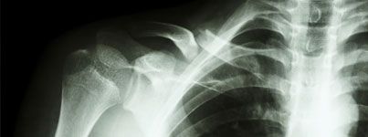 shoulder injury