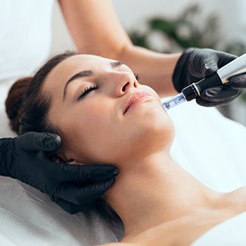 Microneedling