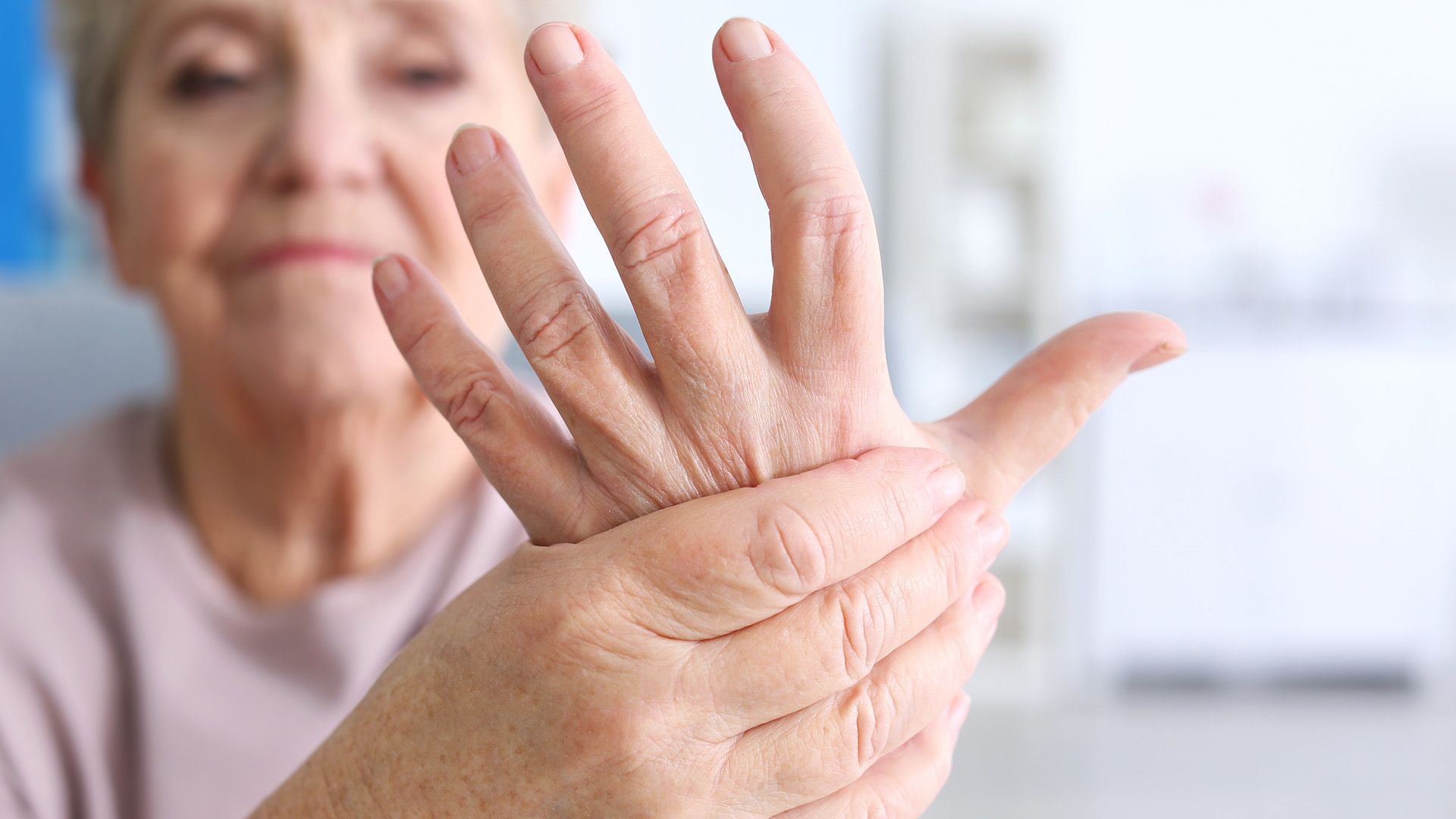 Rheumatoid Arthritis
