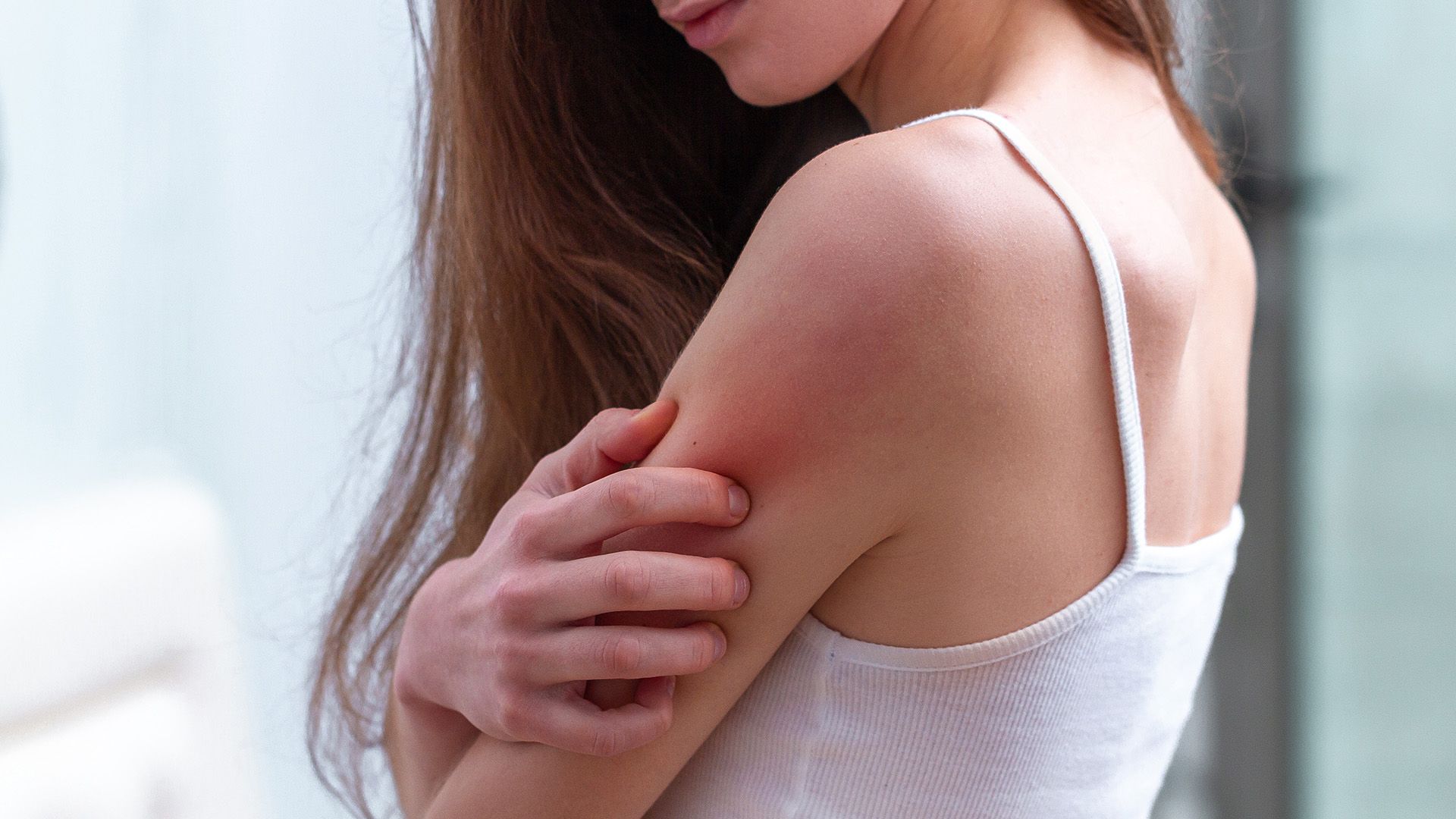 Eczema, Psoriasis and Acne