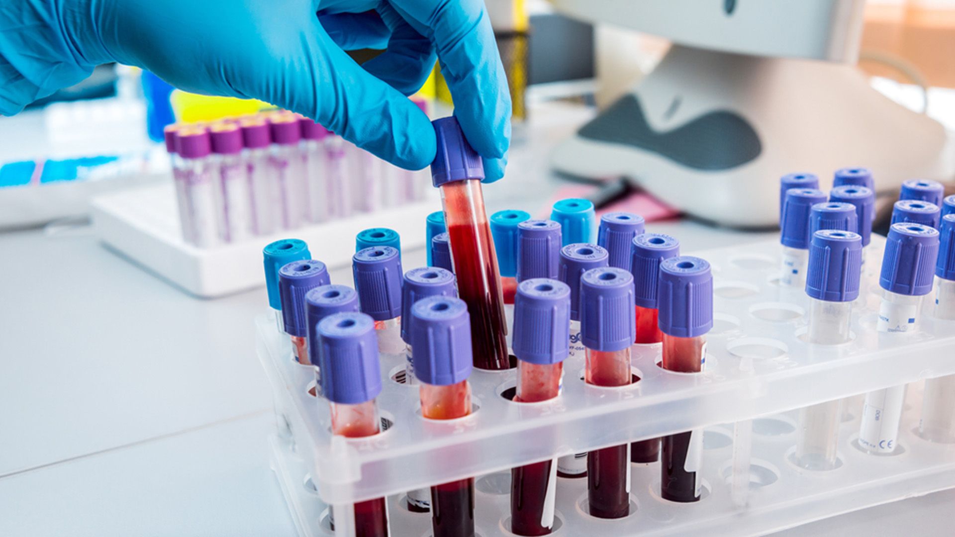 Nutritional Blood Analysis