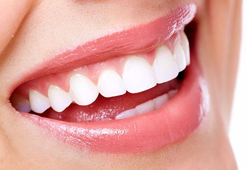 Teeth Whitening in Denver