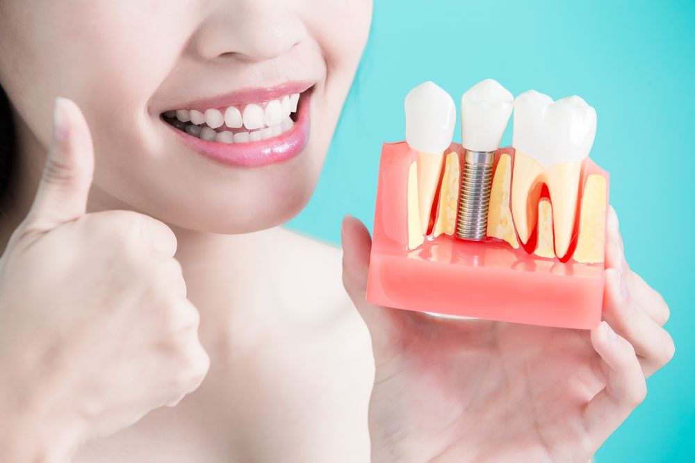 Dental Implant Bone Grafting