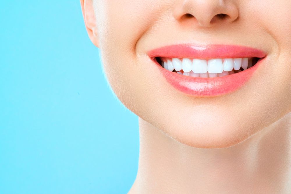 Professional Teeth Whitening Results: How Long Do They Last? 