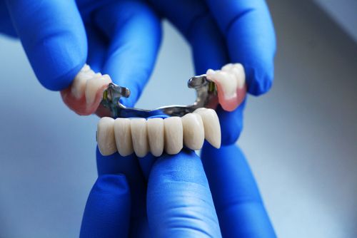 dental bridges