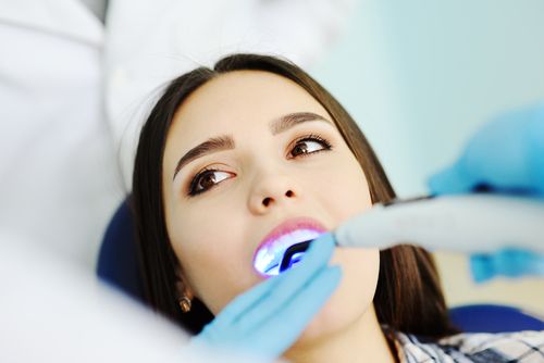 dental fillings
