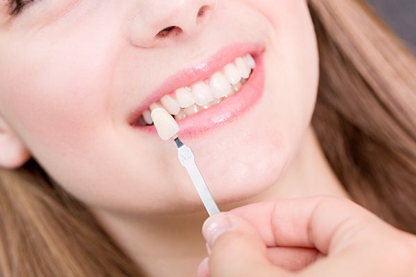 lady choosing her veneers