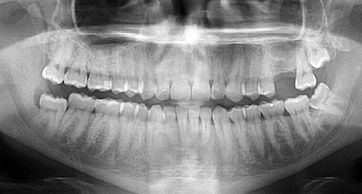 dental xray