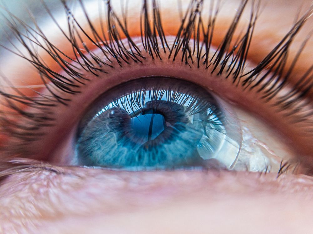 How Scleral Lenses Can Help With Dry Eyes