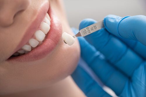 smiling lady getting dental crowns