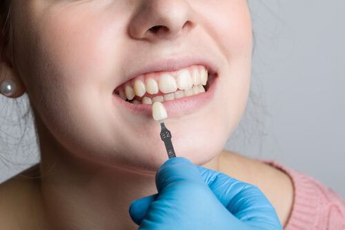 lady choosing veneers