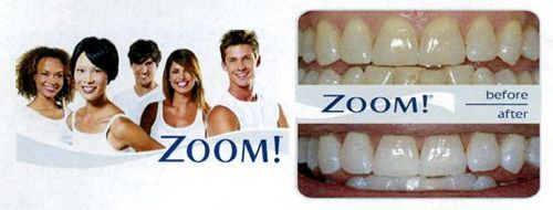 zoom! whitening
