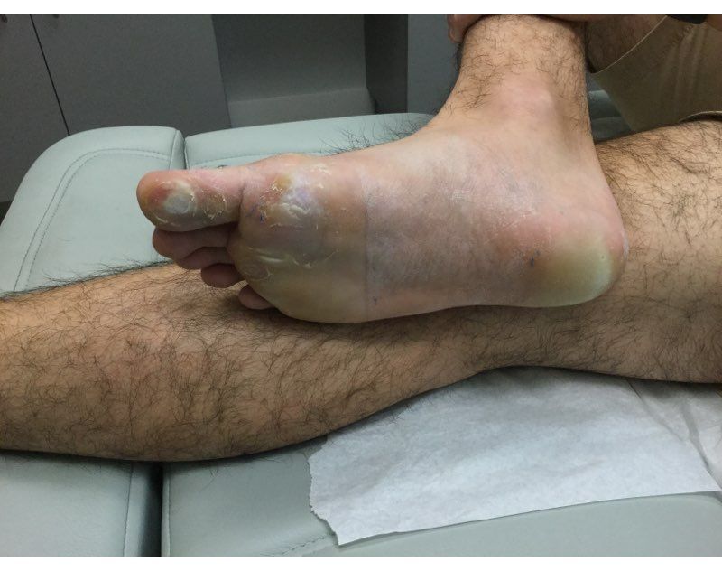 Swift Before Treatment