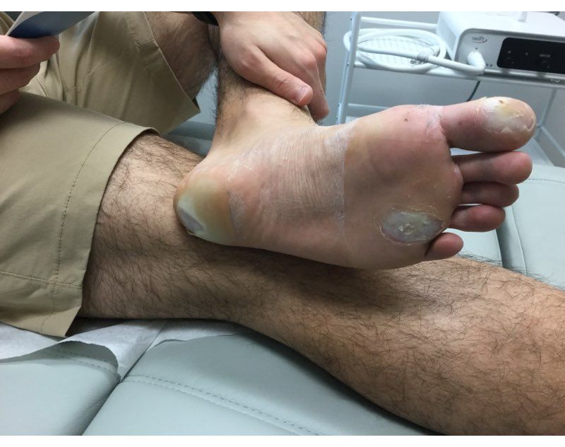Swift Before Treatment