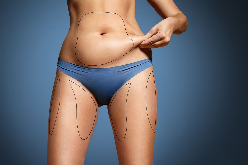 Laser Lipo for Stubborn Areas: Targeting Trouble Spots for Weight Loss