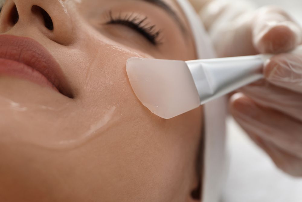 Chemical Peels: A Guide to Achieving Smooth, Younger-looking Skin