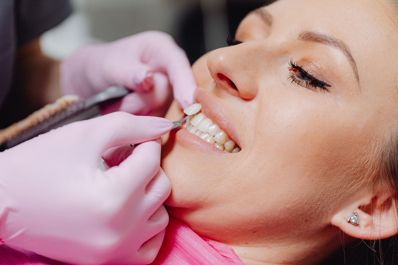 Are Dental Veneers Right for Me? Signs You're A Candidate (and Other Dental Veneer Questions, Answered!)