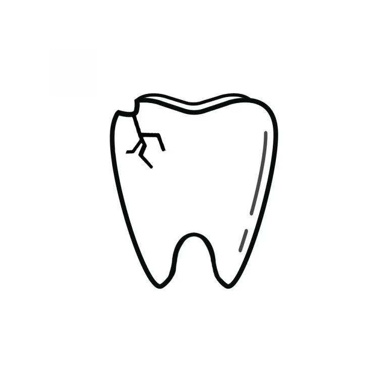 I Chipped a Tooth! What Can I Do? | Dentist Back of the Yards