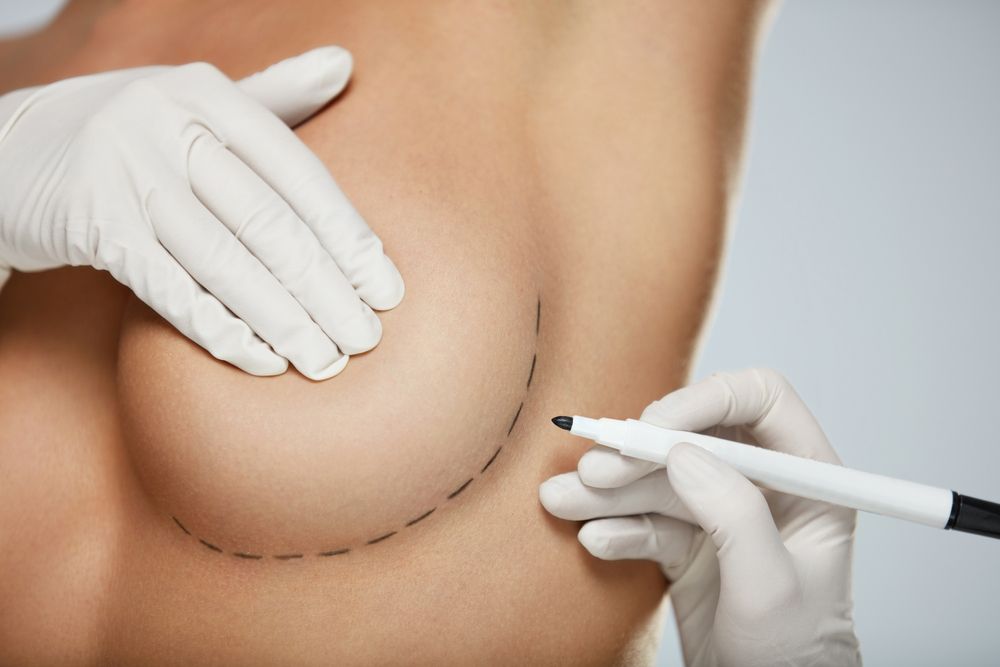 Breast procedures