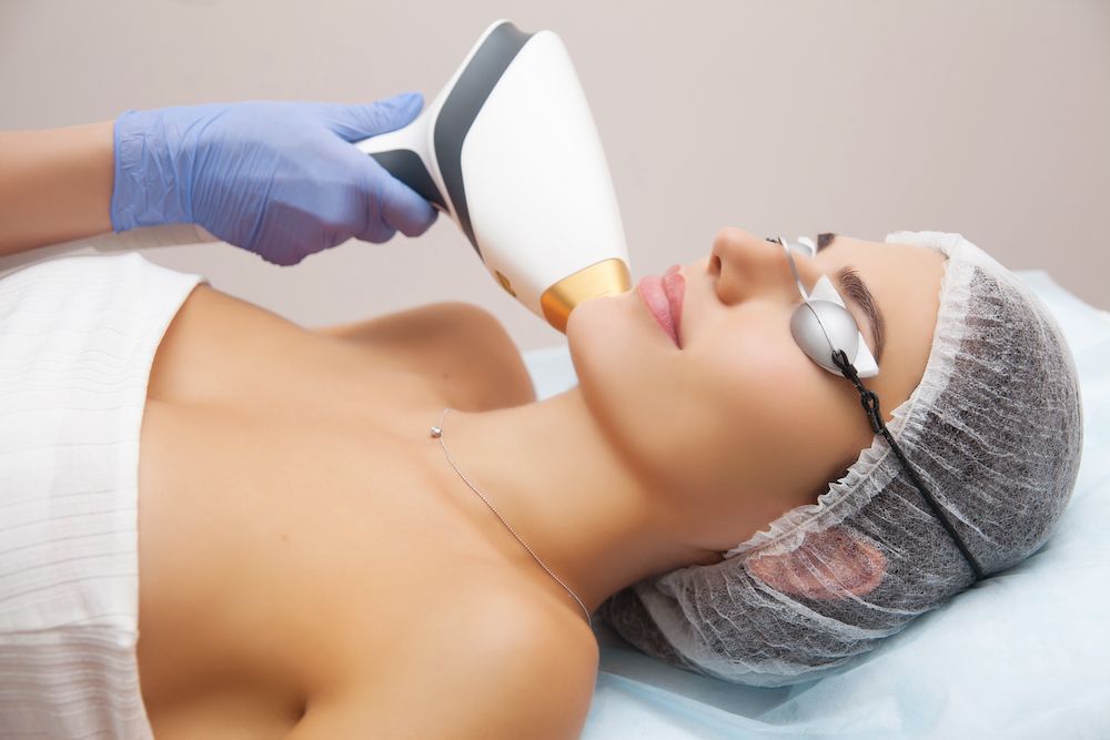 Get Rid of Acne Damage With IPL Laser Therapy