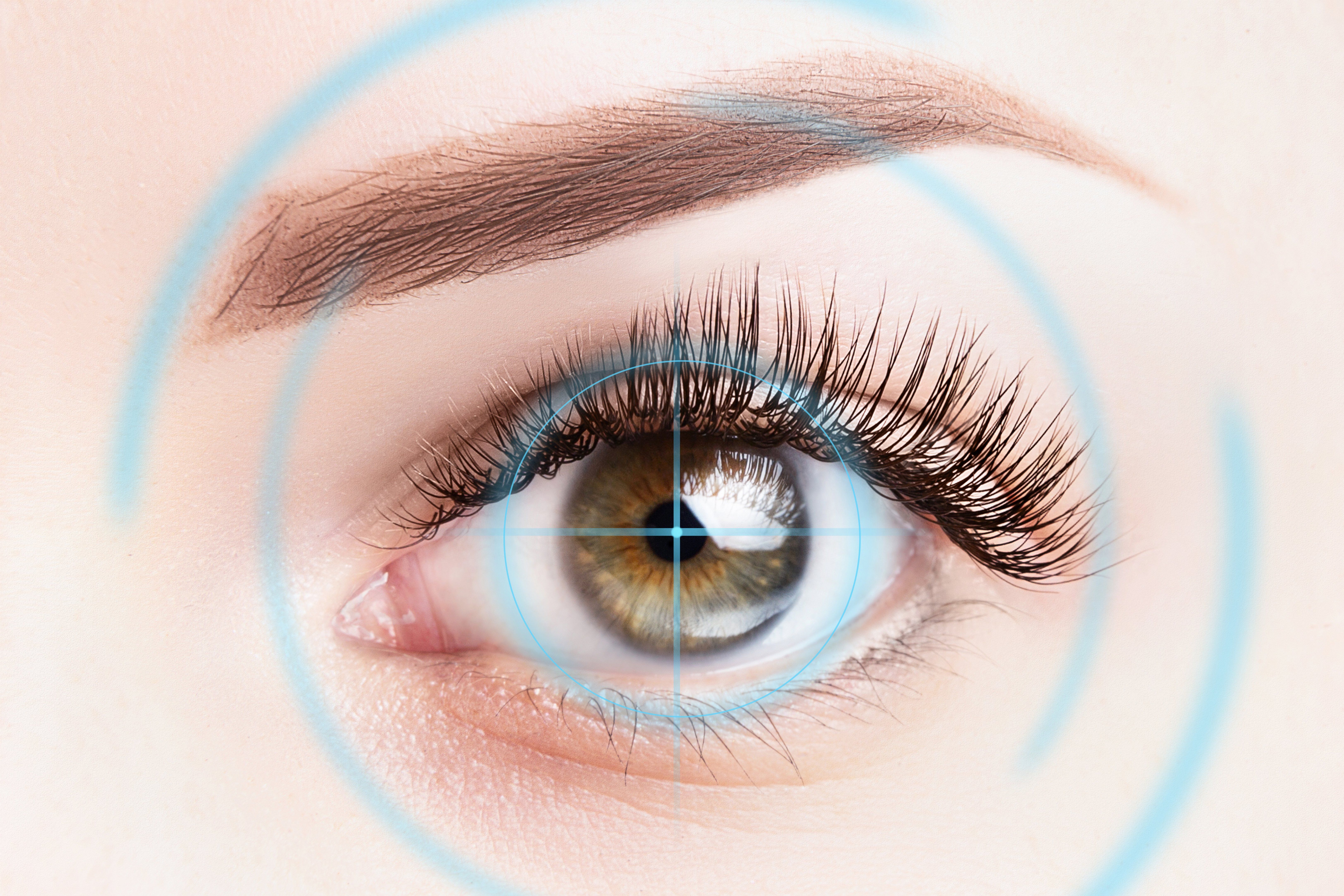 The Long-term Cost of Not Getting LASIK