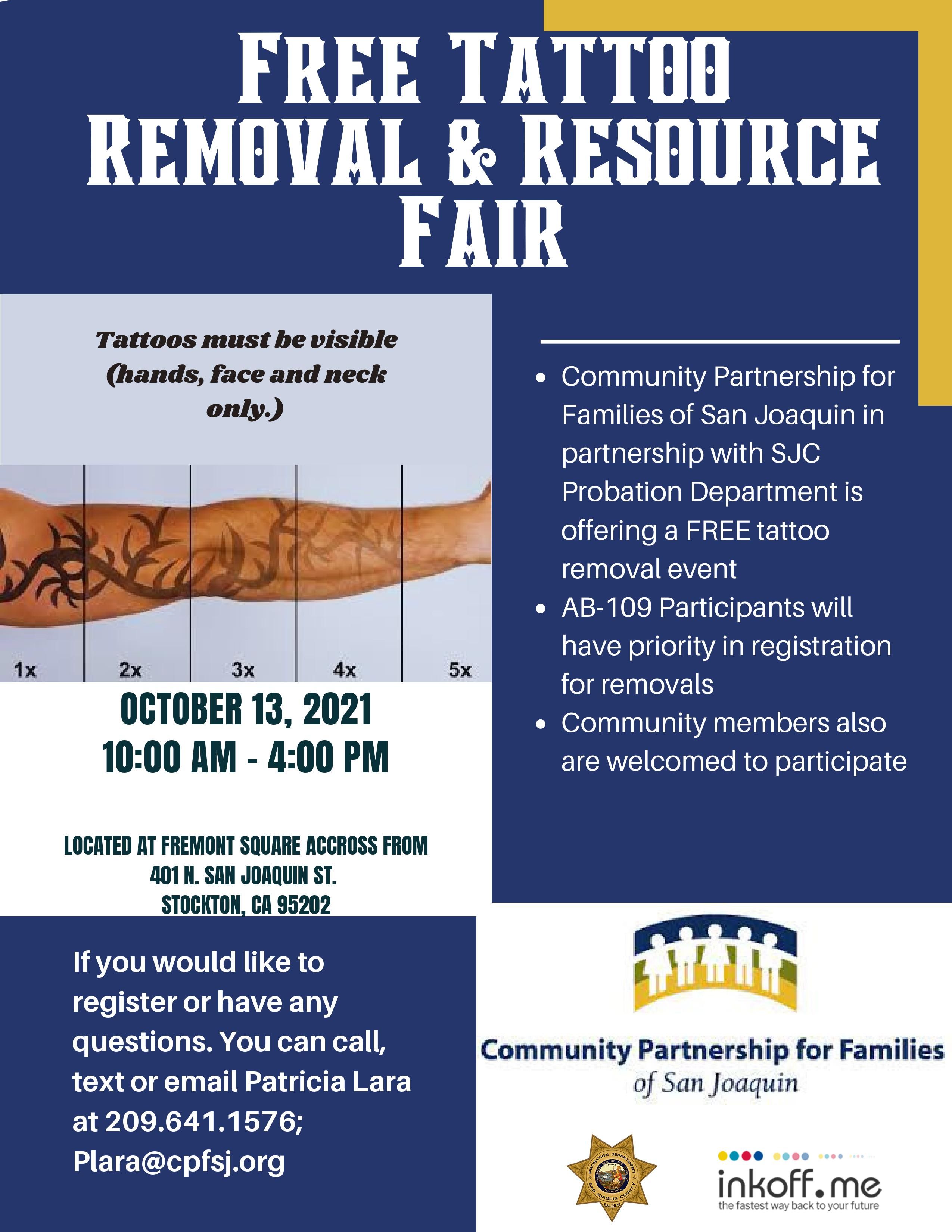 Tattoo Removal Event 