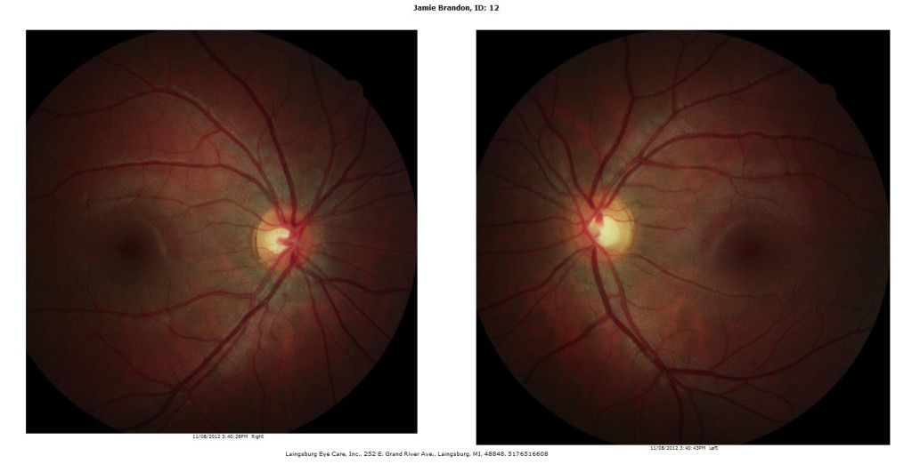 retinal scanning