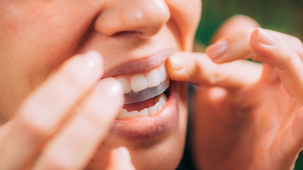 Why Your Teeth Whitening Strips Aren't Working 