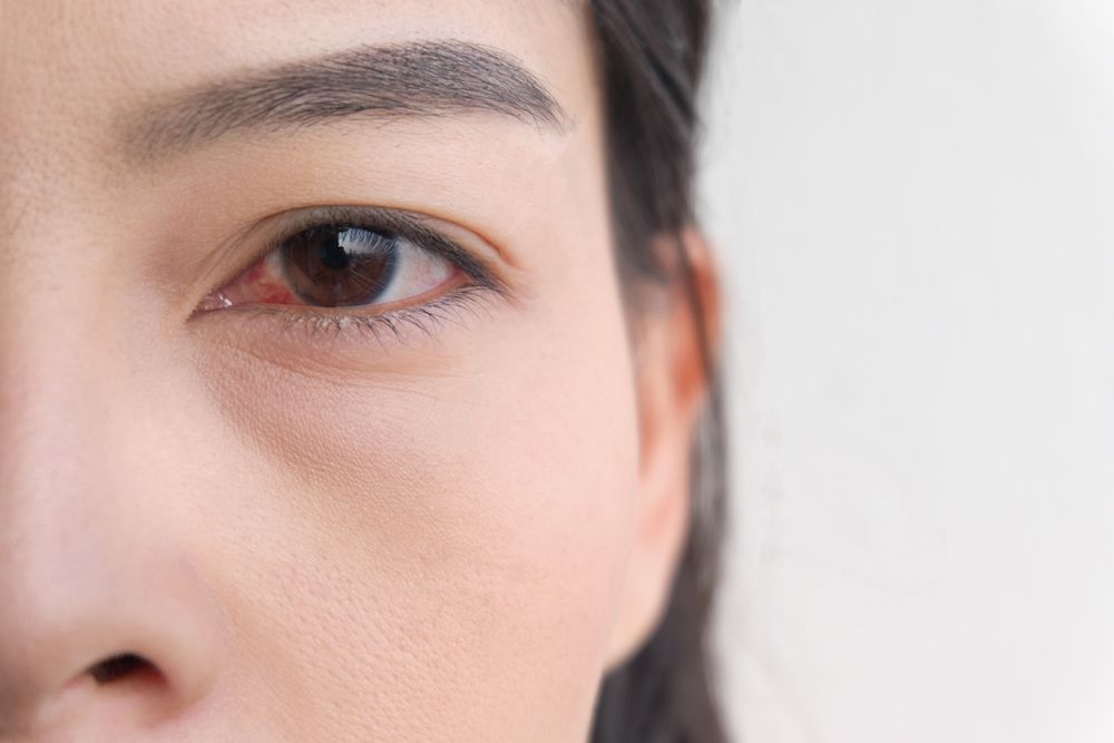 How is Dry Eye Disease Diagnosed?