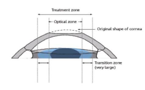 Cornea 1