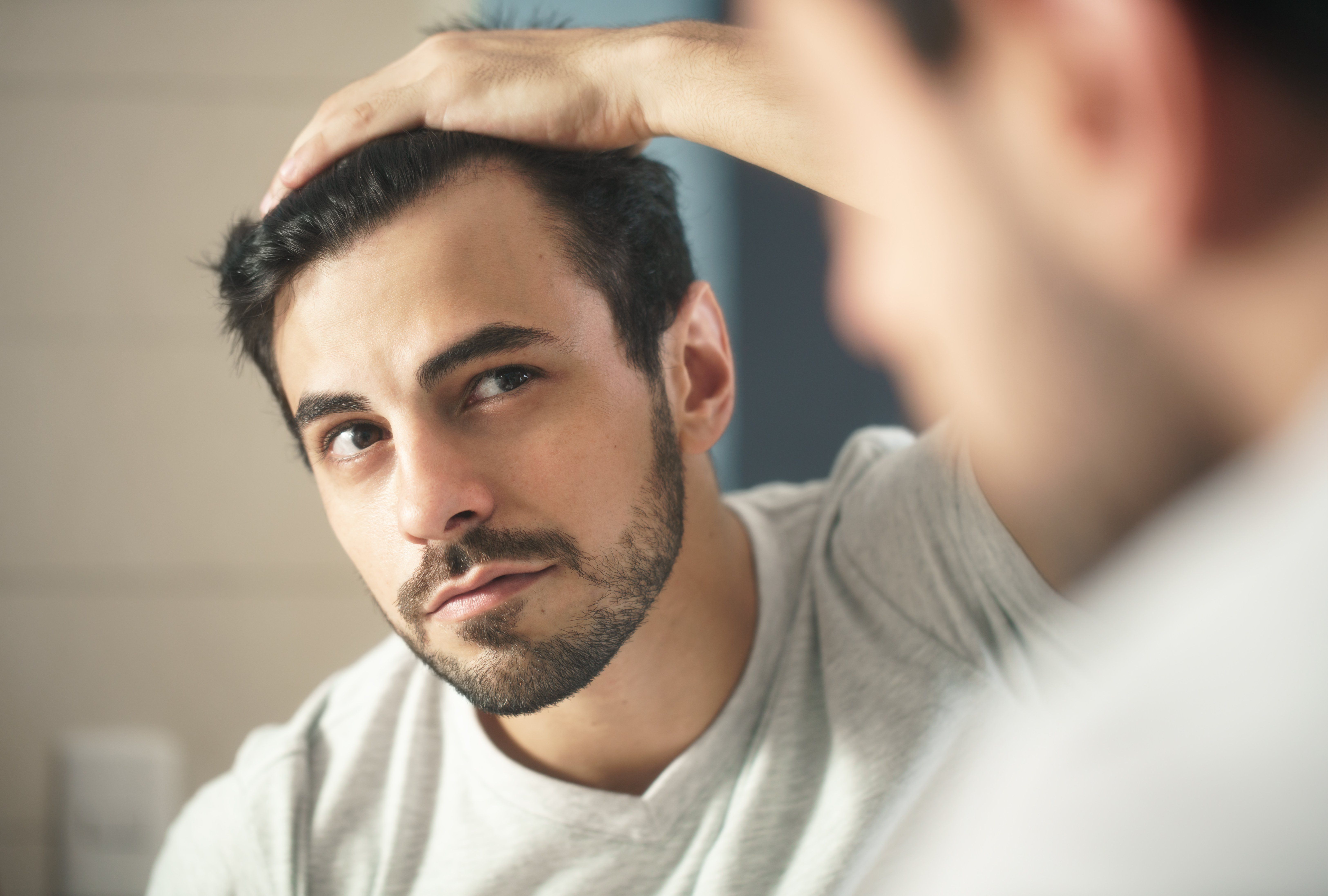 When to Consider SmartGraft® Hair Restoration