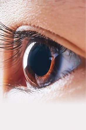 Reshaping the Cornea