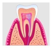 Root Canal Treatment