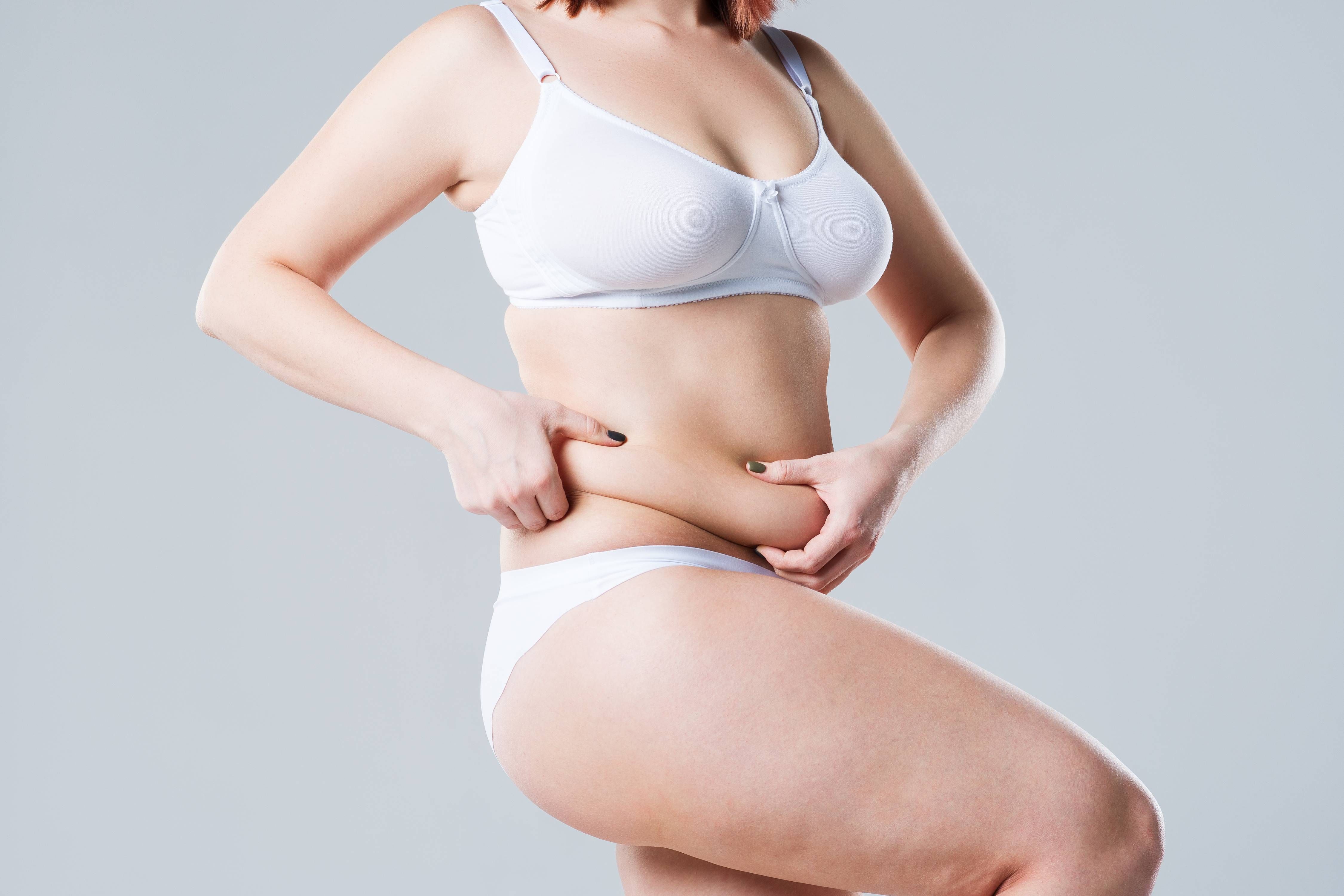 tummy tuck
