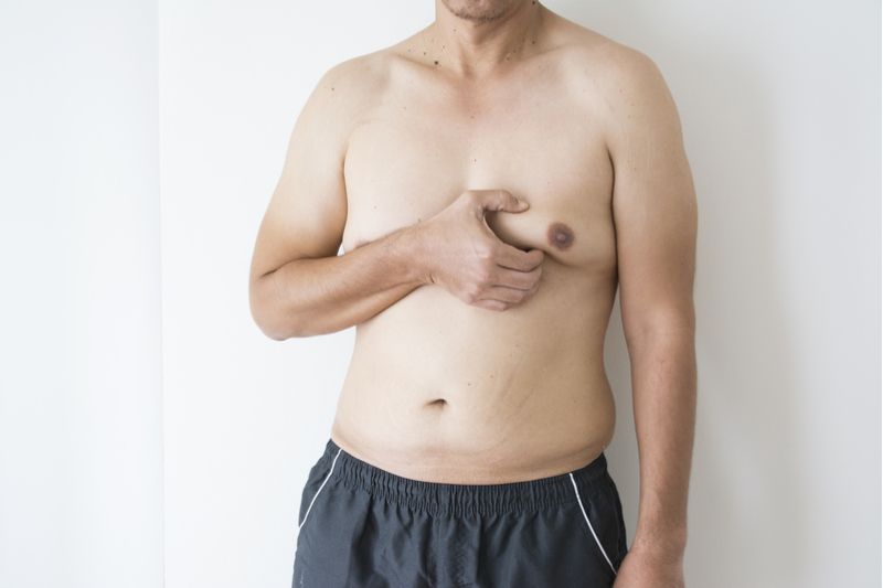 male chest fat